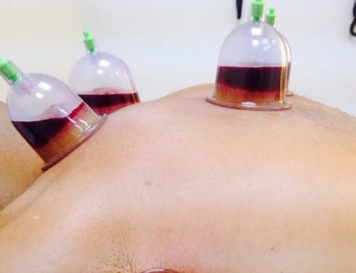 Cupping formation in Rabat-Hassan